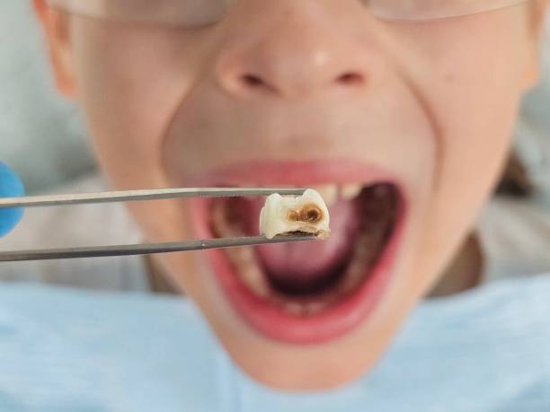 Best Dentist for Severe Toothache  in North Kansas City, MO
